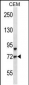 FOXO3 Antibody (Center)